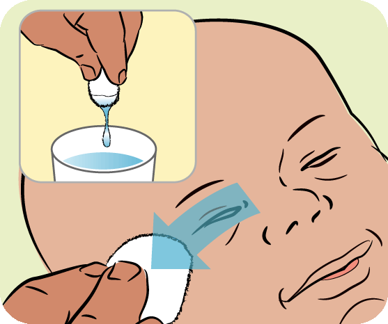 Intradermal Injection